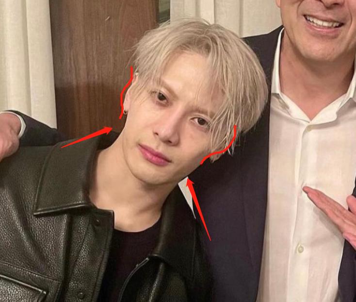 深度解析明星整容后遺癥，觀點(diǎn)與影響探討